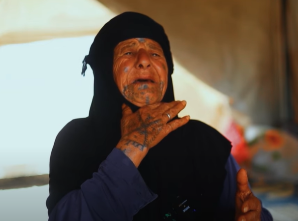 السيدة علية.. احترقت معينتها الوحيدة!